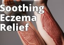 The Ultimate Guide To Cbd Oil Benefits For Eczema Treatment