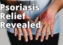 Discover The Secret To Clear Skin: Cbd Oil Benefits For Psoriasis